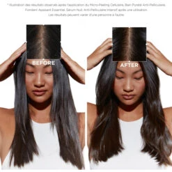 Micro-peeling Cellulaire Symbiose Kérastase 200ML -Hair Pro Promos Magasin micro peeling cellulaire symbiose kerastase 200ml 2