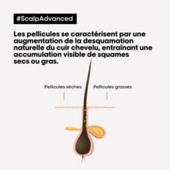 Shampooing Clarifiant Antipelliculaire Scalp Advanced L'Oréal Professionnel 500ML -Hair Pro Promos Magasin shampooing clarifiant antipelliculaire scalp advanced l oreal professionnel 500ml 4